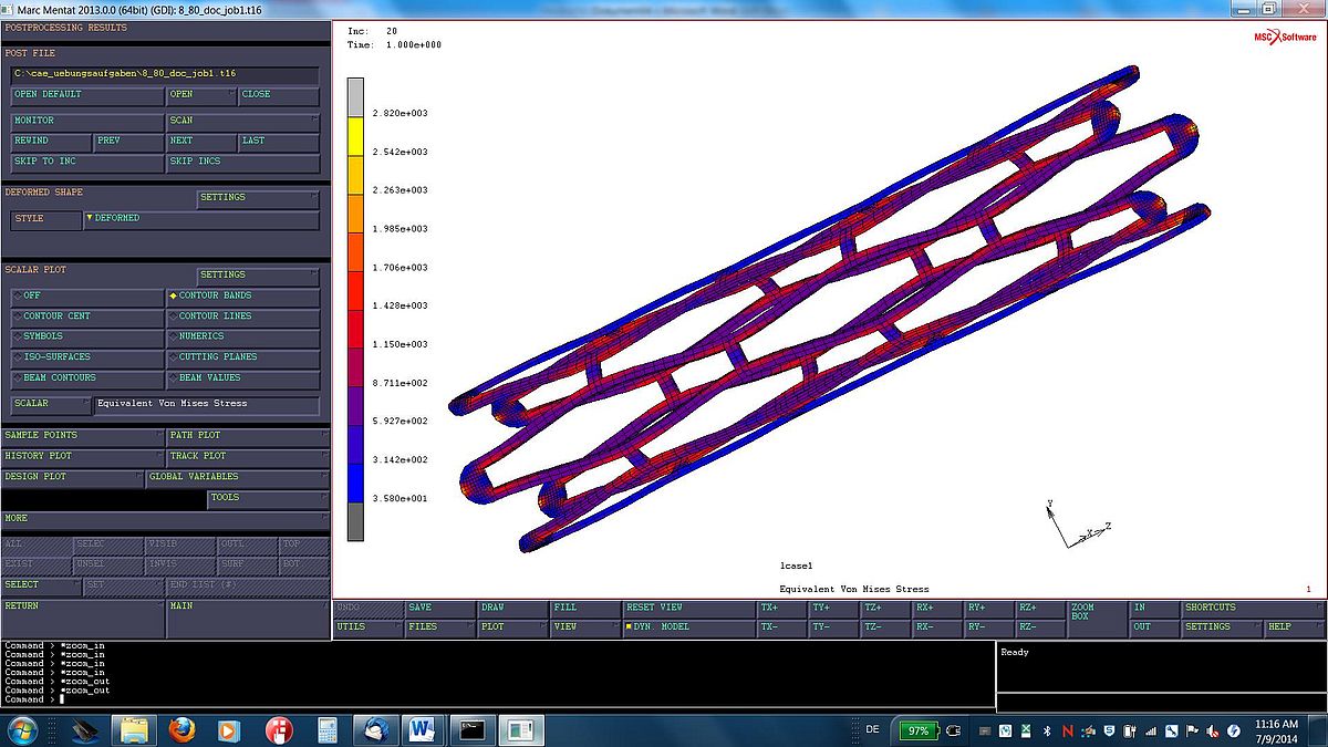 Computer Aided Engineering Simulationen und Analysen in der Medizin