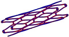 CAE Simulation Stent